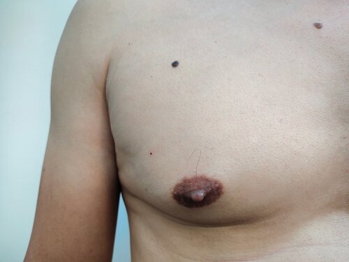 david hinde recommends puffy women nipple pic