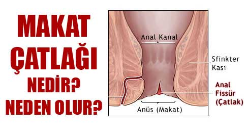 yanik anal