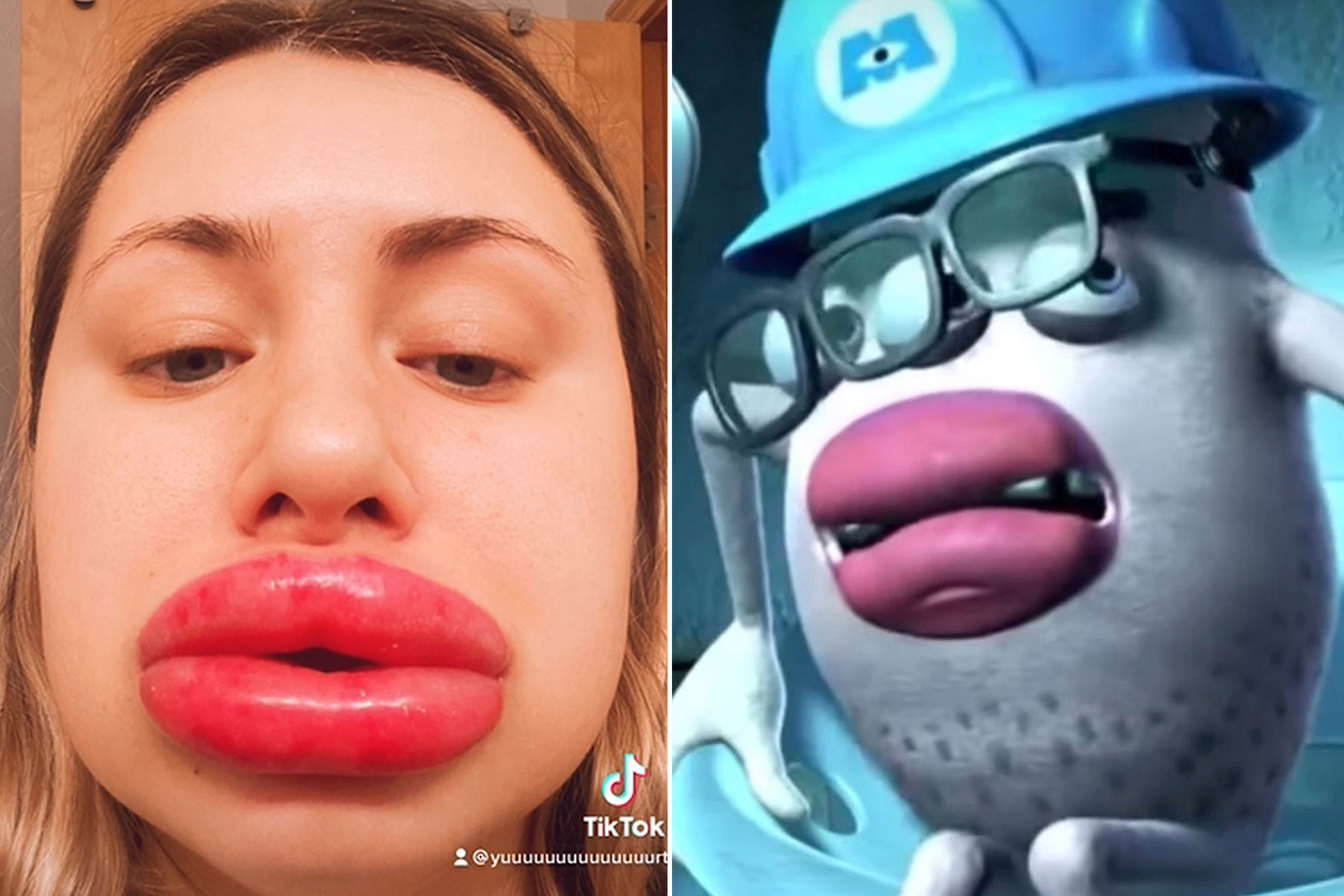 fake lips porn