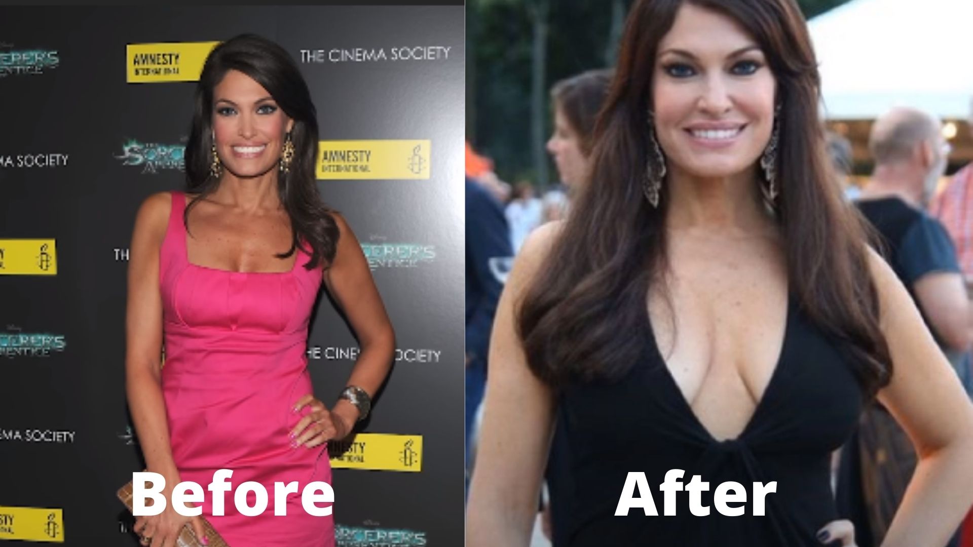 dennis strassburg add photo kimberly guilfoyle tits