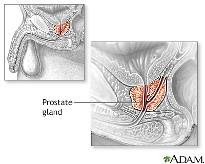 Best of Cum during prostate exam