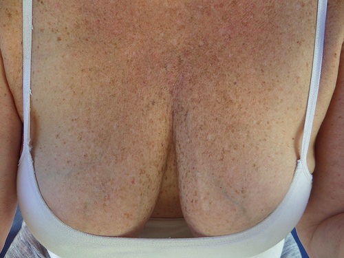 cj waite recommends freckled titties pic