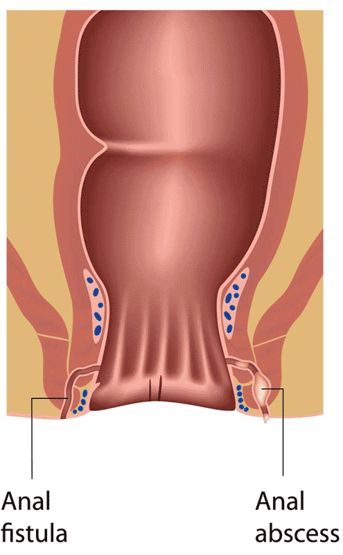 amir taub recommends Anal Category