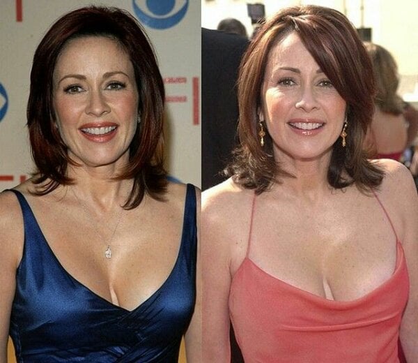 chris mavrikios recommends patricia heaton measurements pic