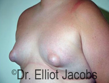 amos smith recommends small puffy titties pic